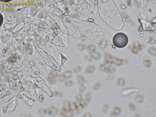 Volvariella murinella - Cheilozystiden - 