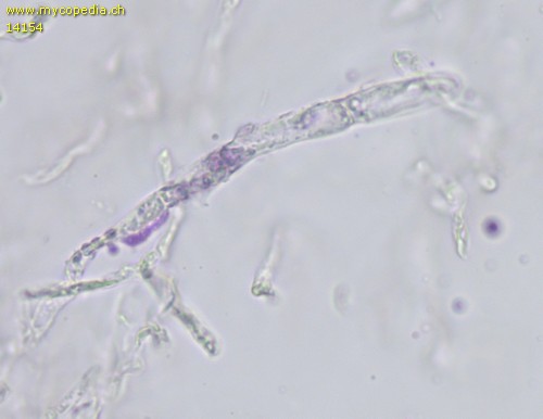 Russula risigallina - Primoridalhyphen inkrustiert - 