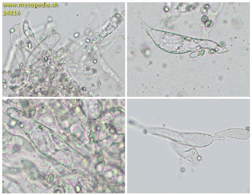 Leucoagaricus leucothites - Cheilozystiden - 