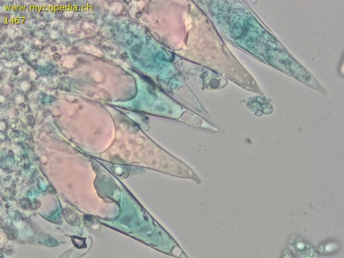 Macrocystidia cucumis - Cheilozystiden - 