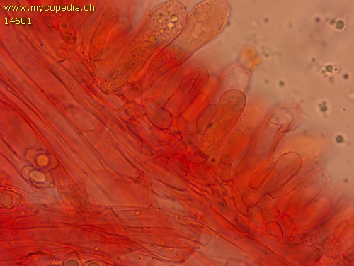 Entoloma poliopus - Cheilozystiden und Basidien - 