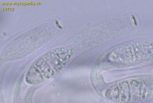 Seimatosporium massarina - 