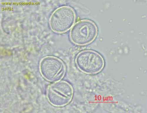 Lasiobolus microsporus - Sporen - Wasser  - 