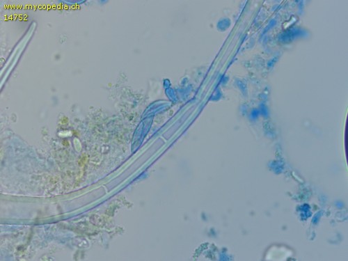 Lasiobolus microsporus - Setae, septiert - 