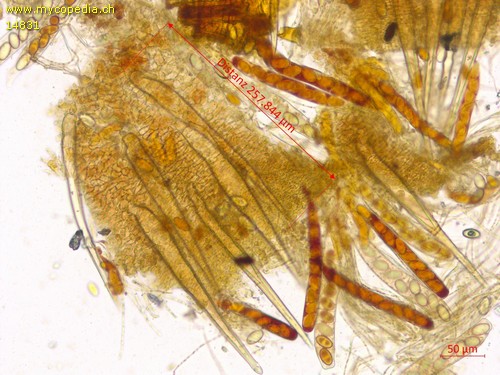 Lasiobolus ciliatus - Setae - 