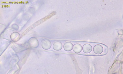 Caloscypha fulgens - Ascus - 