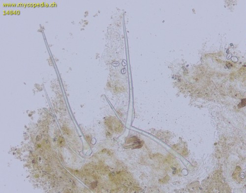 Lasiobolus microsporus - 