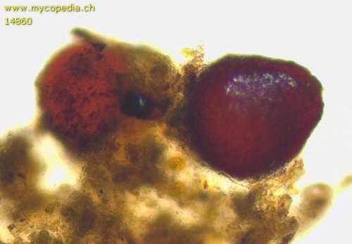 Pseudocosmospora eutypellae - 