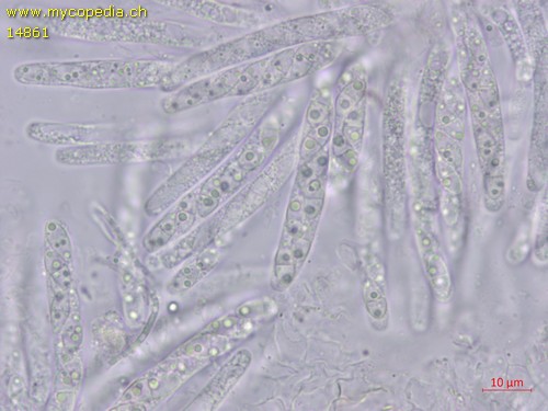 Pseudocosmospora eutypellae - 