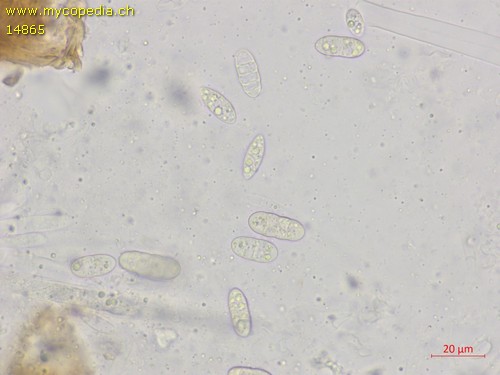 Seimatosporium massarina - 