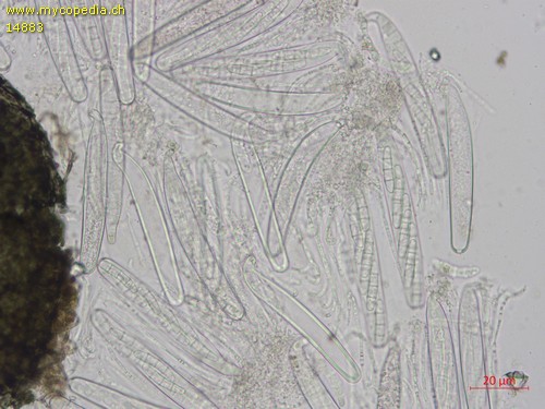 Sporormiella intermedia - Asci - Wasser  - 