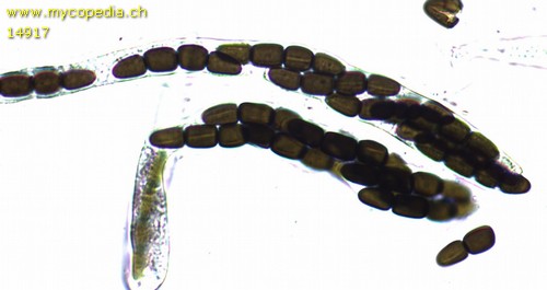 Sporormiella intermedia - Asci - Wasser  - 
