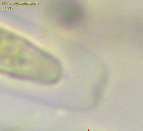 Barbatosphaeria barbirostris - Ascusspitze mit Operculum - Melzers  - 