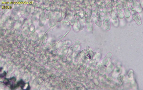 Coprinopsis cinerea - Cheilozystiden - 