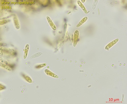 Pyrenopeziza atrata - Sporen - Baral  - 