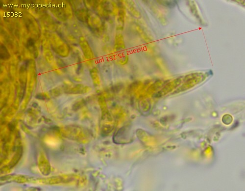 Pyrenopeziza atrata - Spore/n - barals  - 