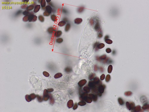 Coprinopsis filamentifer - Cheilozystiden - Wasser  - 
