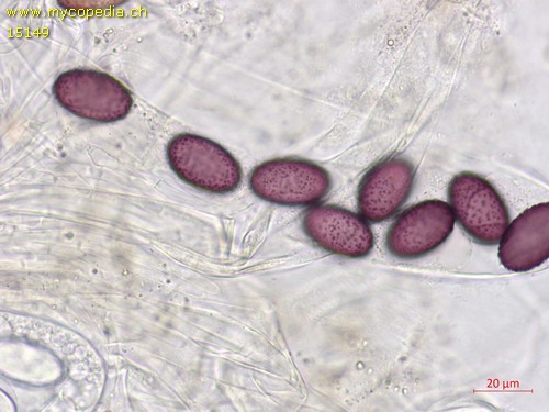 Ascobolus spp - 