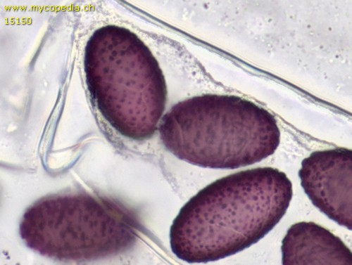 Ascobolus spp - 