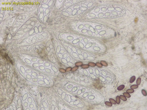 Ascobolus spp - Excipulum - 