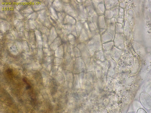 Ascobolus spp - 