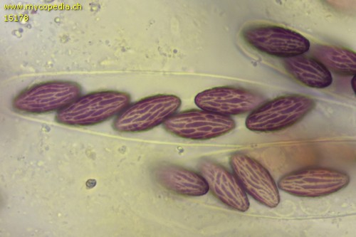 Ascobolus michaudii - Sporen - Wasser  - 
