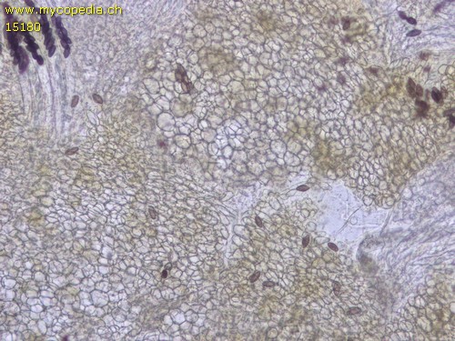 Ascobolus michaudii - Textura prismatica - 