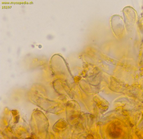 Pezicula cinnamomea - Marginalzellen - 