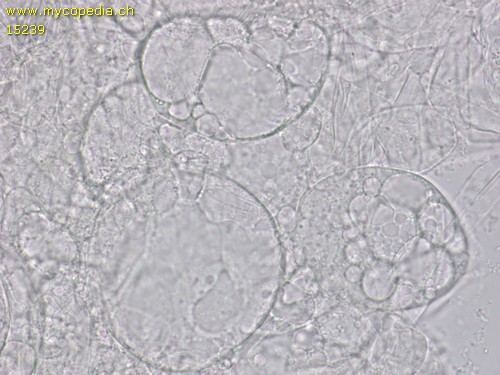 Peziza vesiculosa - Textura globosa - 