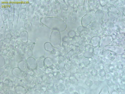 Coprinopsis stercorea - Cheilozystiden - Wasser  - 