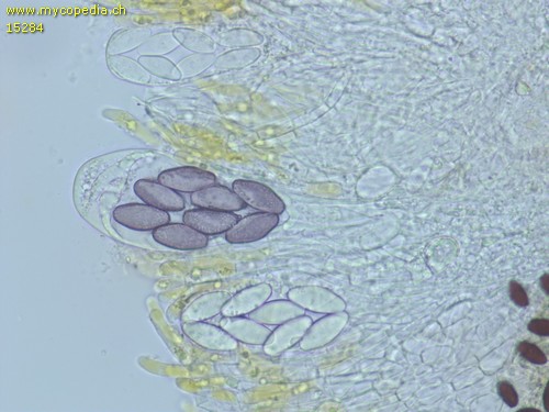 Saccobolus citrinus - Ascus/Asci  mit unreifen Sporen - Wasser  - 