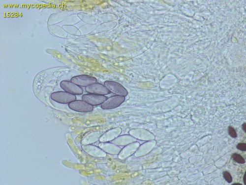 Saccobolus citrinus - Ascus/Asci  mit unreifen Sporen - Wasser  - 