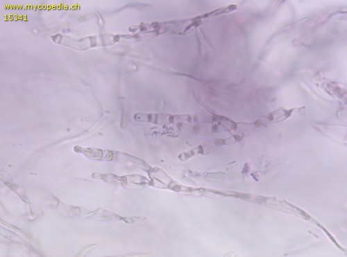 Russula vesca - Pileozystiden - 