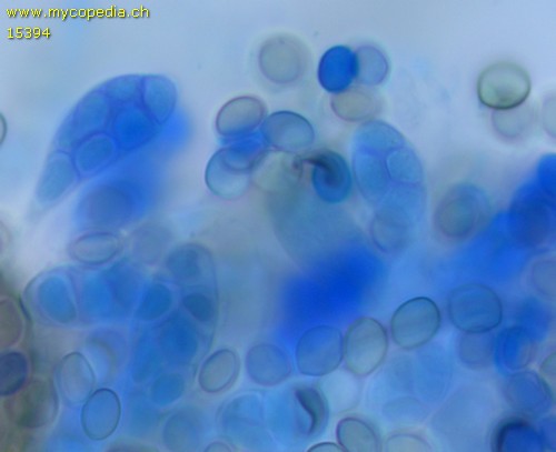 Chaetomium bostrychodes - Asci - Patentblau  - 