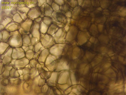 Chaetomium bostrychodes - Textura angularis - 