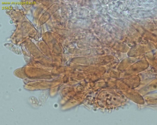 Collybiopsis ramealis - Cheilozystiden - Kongorot  - 