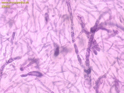 Russula integra - Primoridalhyphen inkrustiert - 