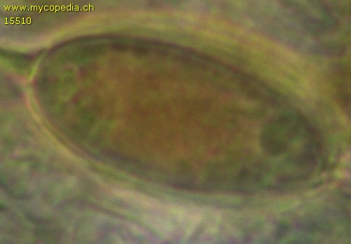 Thecotheus uncinatus - Spore/n - Wasser  - 