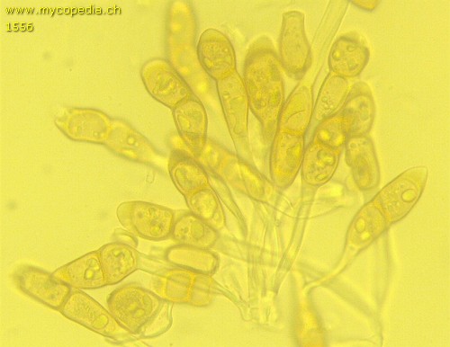 Puccinia arenariae - Teleuto- / Teliosporen - 