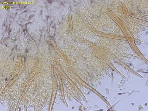Scutellinia pseudotrechispora - 