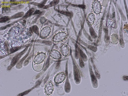 Scutellinia pseudotrechispora - 