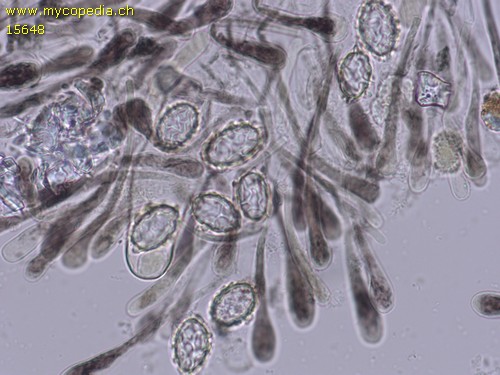 Scutellinia pseudotrechispora - 