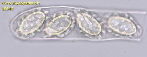 Scutellinia pseudotrechispora - 