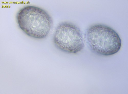 Scutellinia subhirtella - Sporen - Wasser  - 