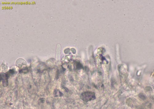Lyophyllum tenebrosum - Cheilozystiden - Wasser  - 