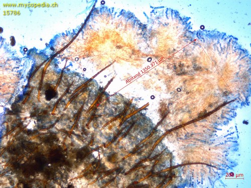 Scutellinia trechispora - Randhaare - 