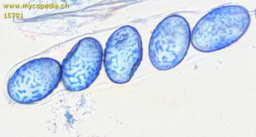 Scutellinia kerguelensis - Sporen - Baumwollblau  - 