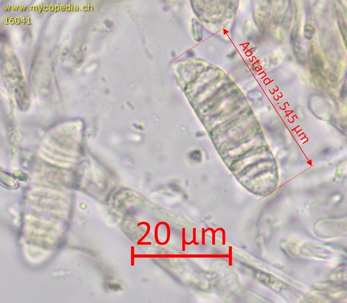 Ditiola peziziformis - 