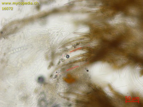 Trichophaea woolhopeia - 