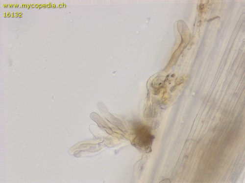 Hydropus marginellus - Kaulozystiden - 